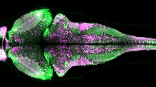 Una nueva proteína hace visible la actividad neuronal en seres vivos